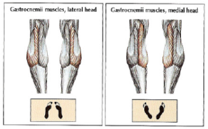 gastrocnemius medial lateral