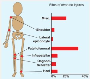 overuse injuries sport injury