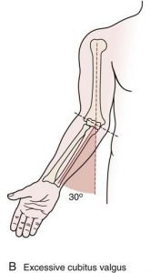 elbow angle valgus