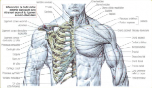 acrominioclavicular problem