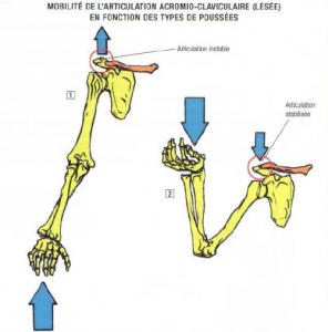 acrominioclavicular problem