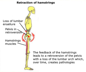 hamstring muscle anatomy tear pelvis 