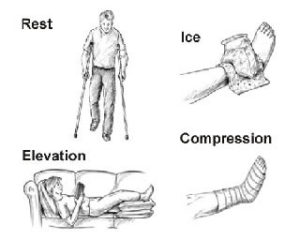 ankle sprain rice rest ice compression elevation