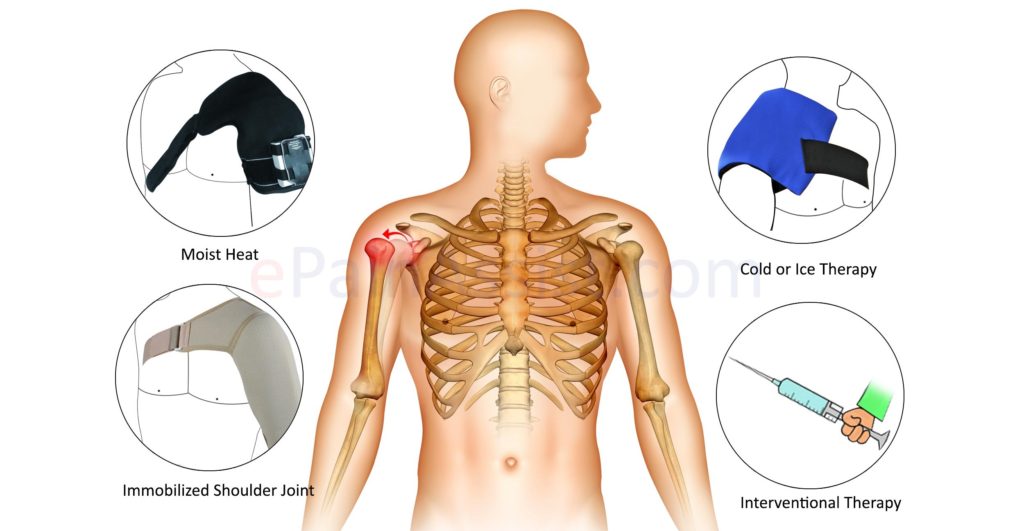 Shoulder Instability Or Dislocations • Stephane Andre