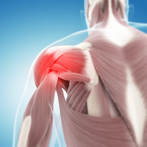 rotator cuff tear anatomy shoulder