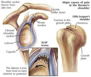 slap tear anatomy shoulder